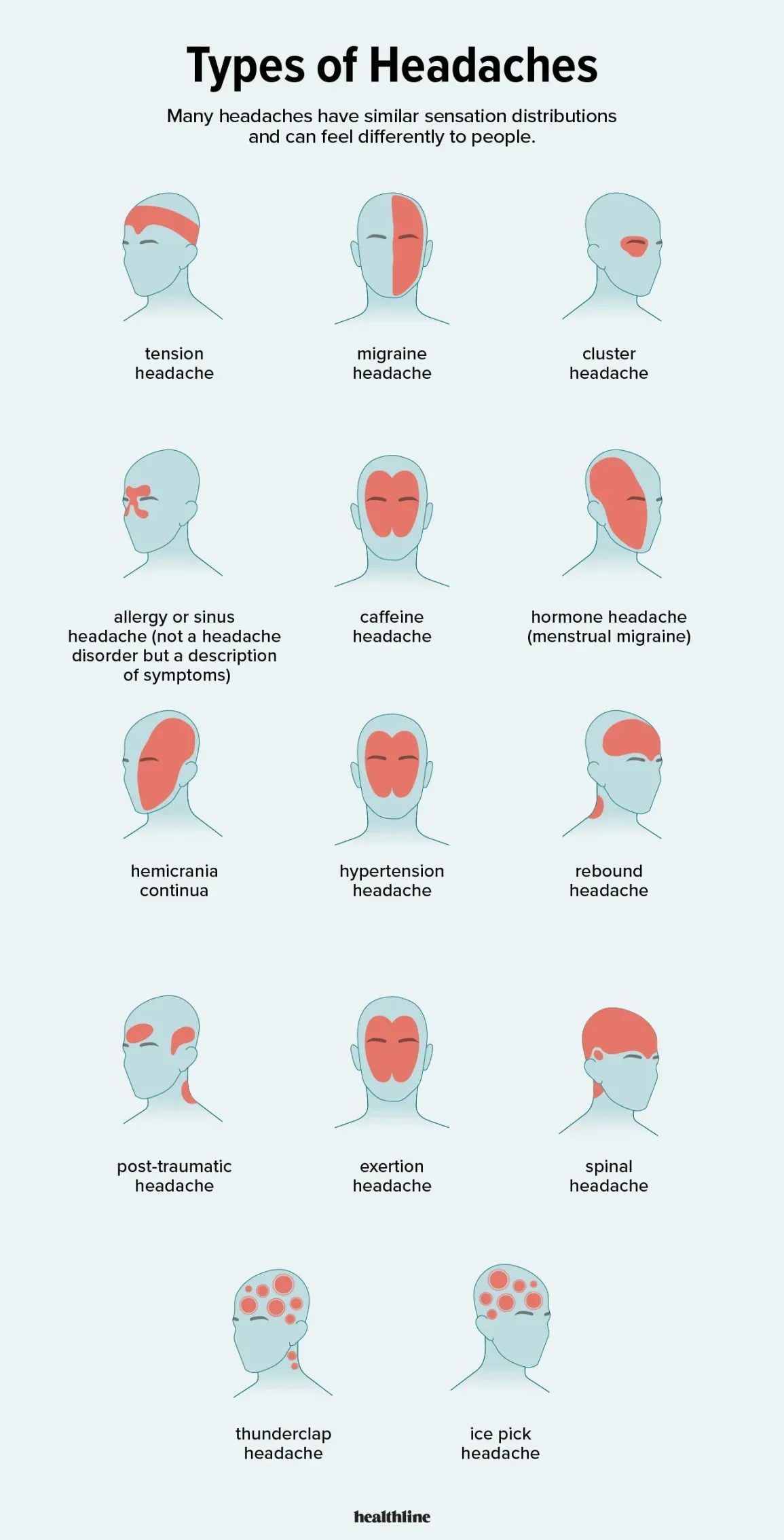 1731029-13-Types-of-Headaches-and-How-to-Treat-Them-1296x2545-Body.webp